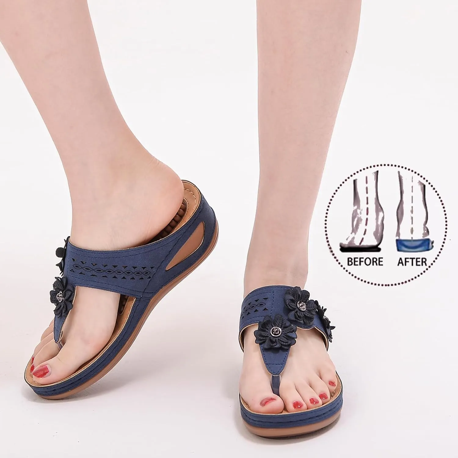 Sandals Women Wedge Shoes Summer Dressy Flip Flops Comfortable Orthopedic Platform Footwear Casual Walking Wedges Sandal Massage Arch Support Orthotic Sandals Slip-On Thong Slides Shoes